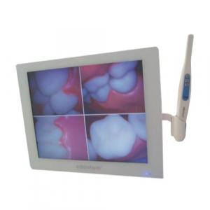 Kit monitor tv, cámara intraoral y brazo para monitor